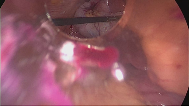 Tissue Recognition